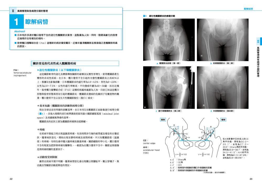 髖關節物理治療實務