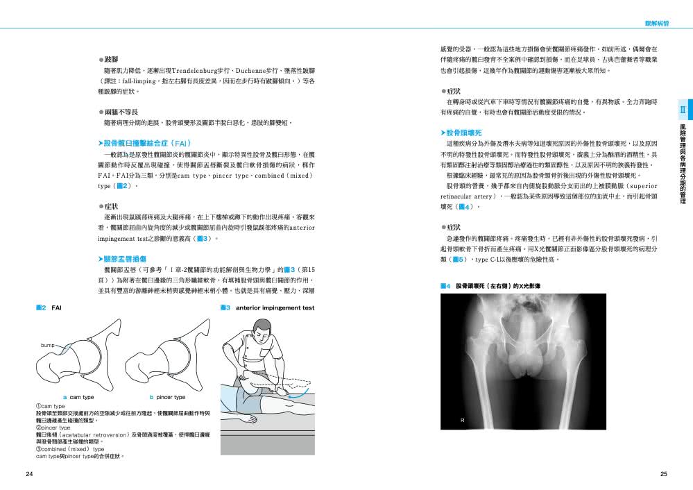 髖關節物理治療實務