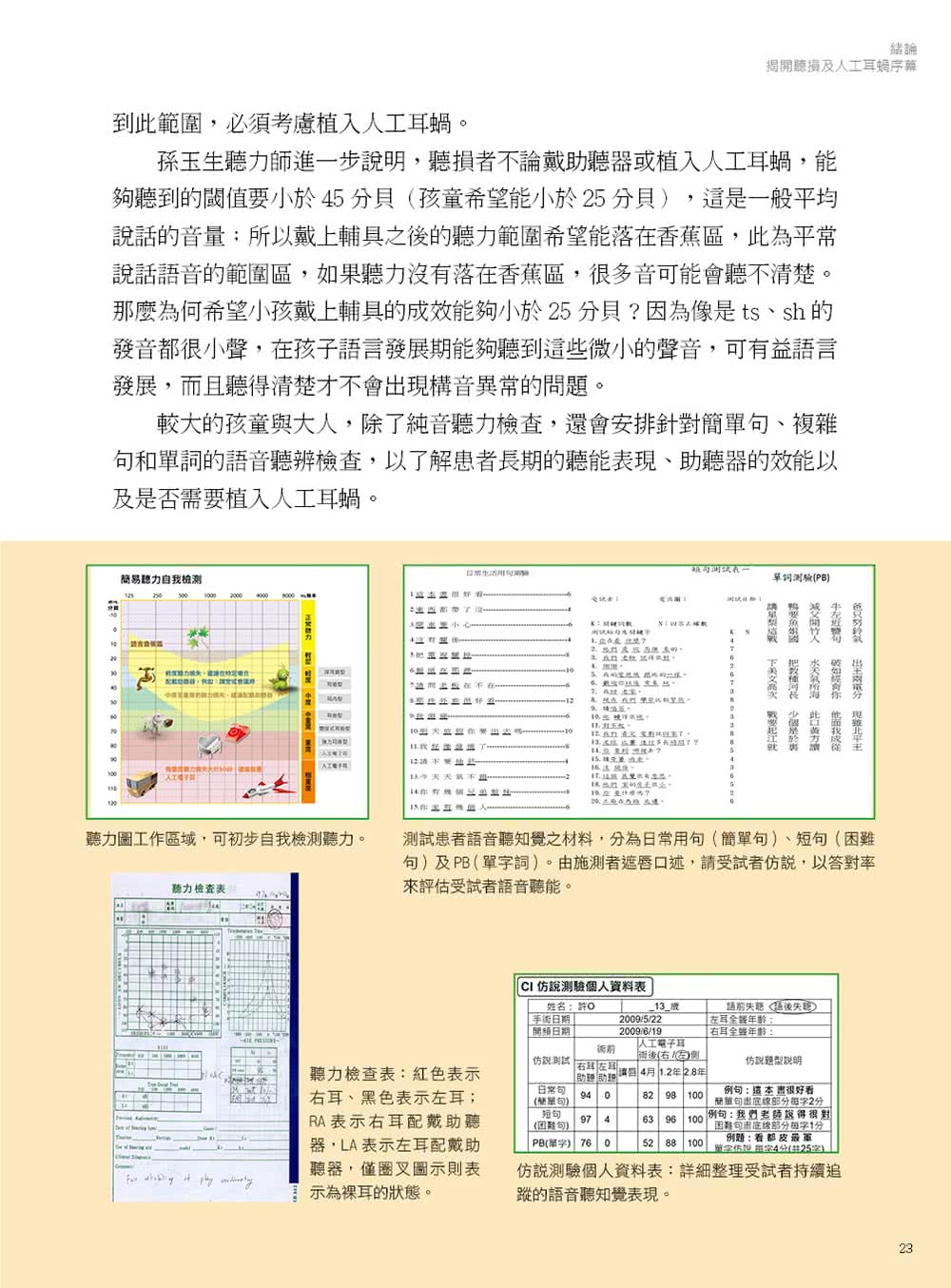 人工耳蝸 翻轉人聲