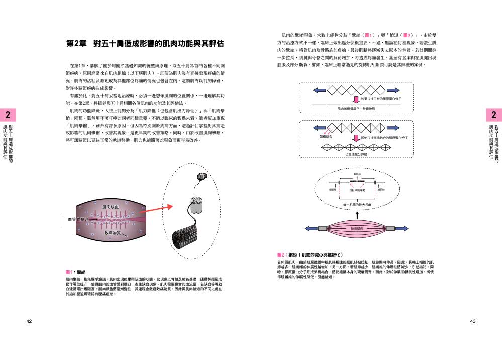 五十肩的診斷與物理治療