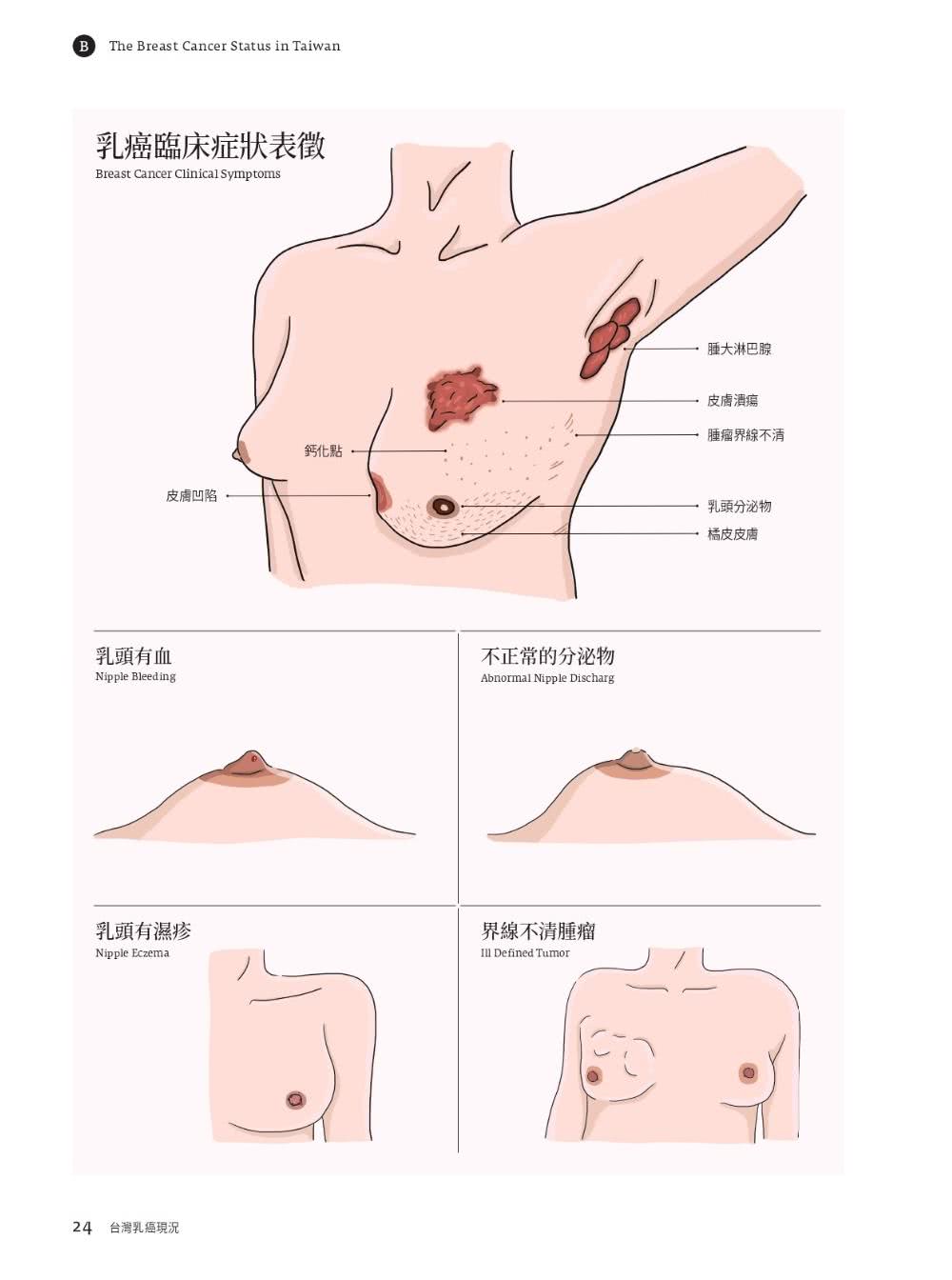 台灣女性乳癌白皮書：100個非知不可的醫學知識 關於妳的乳房 掌上微型Google冊