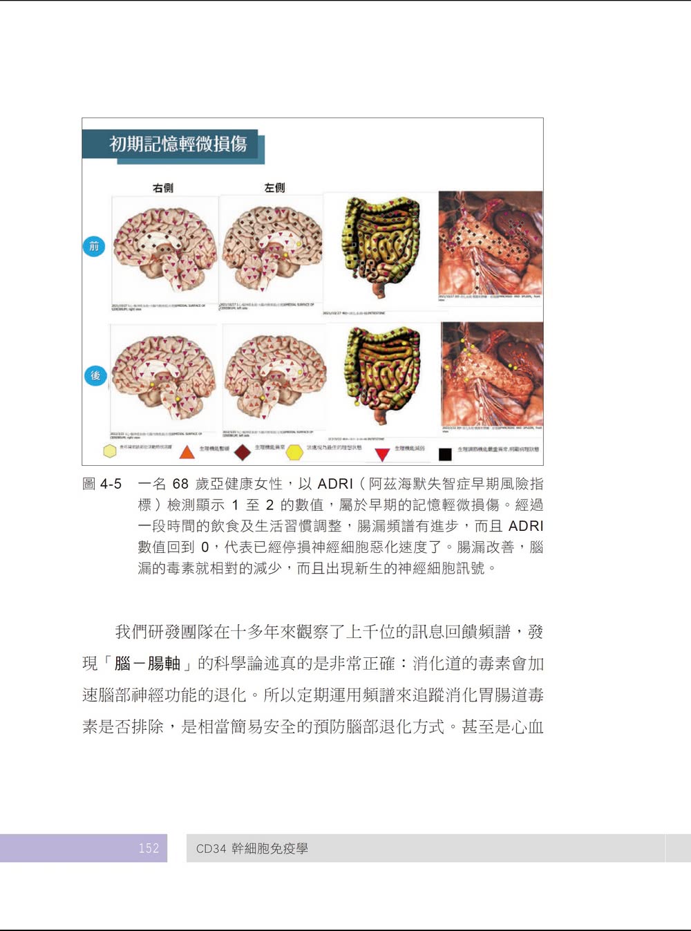 CD34幹細胞免疫學 活化自體保護系統